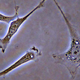 Fibroblastos, vistos al microscopio. Foto: Wikipedia